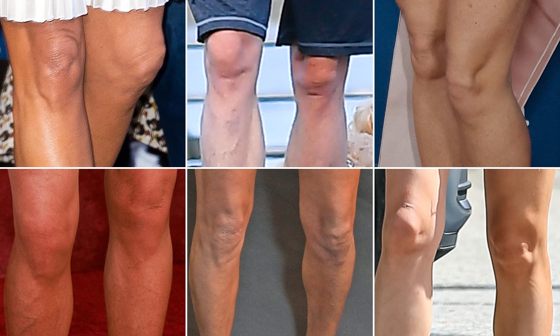 Are your knees making you look old? The seemingly ageless stars who are betrayed by their legs
